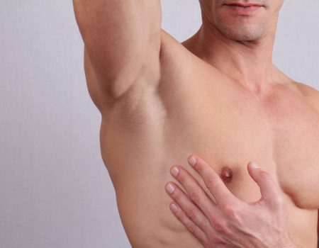 depilacion-laser-masculina-axilas-malaga