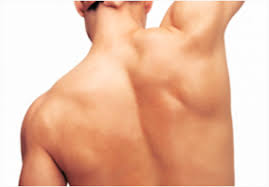 depilacion-laser-masculina-espalda-malaga